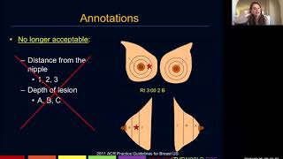 Breast Ultrasound  Part 3  Health4TheWorld Academy [upl. by Teryl540]