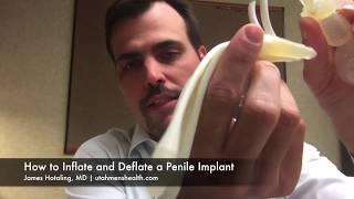 How to InflateDeflate a Penile Implant [upl. by Ennadroj264]