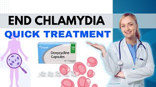 Chlamydia Treatment Explained Everything You Need to Know how to treat chlamydia [upl. by Nitram456]