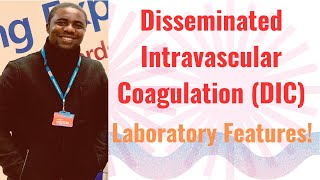 Disseminated Intravascular Coagulation DIC amp Its Laboratory Features II Dr Emmanuel Ogbodo [upl. by Kozloski]