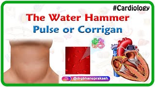 The water hammer pulse or Corrigan hyperkinetic pulse  usmle cardiology [upl. by Carlynn216]