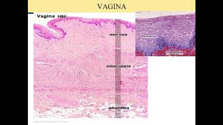 Histologi Sistem Reproduksi Wanita video keempat dari 4 videoServiks dan vagina [upl. by Celio]