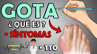 ¿QUÉ ES LA GOTA Y CUÁLES SON LOS SÍNTOMAS TRATAMIENTO 📝👨🏻‍⚕️ EXPLICACIÓN FÁCIL⚡ [upl. by Frances23]