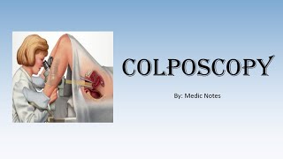 OampG Colposcopy  for medical students indications procedure abnormal results [upl. by Aneeuq]