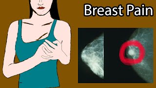 Breast Pain Mastalgia Symptoms Causes and treatment Cyclic mastalgia [upl. by Yenttirb]