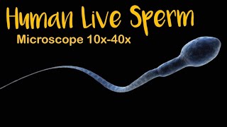 Semen Analysis  human sperm live  fertility  sperm under microscope [upl. by Clarise]