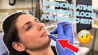 Sphenopalatine Ganglion Block for Treatment of Headaches [upl. by Hugibert647]