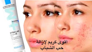 كريم effaclar duoM السحري لإزالة الحبوب والرؤوس السوداء وإزالة التصبغات 🤨اليوم نجاوب على أسئلتكم [upl. by Anhavas]