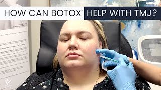 How Long Does Masseter Botox Last [upl. by Renato]