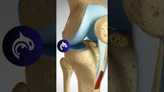 ACL Reconstruction  Patellar Harvest  3D Animation knee kneepain kneerehab [upl. by Pelagia]