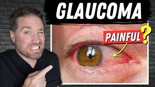 Open Vs Closed Angle Glaucoma Painful Glaucoma [upl. by Alehtse]