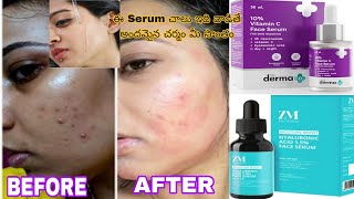 ZM Zayn amp Myza Face Serum  Derma co vitamin C 10 serum oily dry skin REVIEW best vitamin [upl. by Edson947]