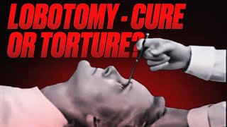 The SHOCKING TRUTH About Lobotomy and Why Its Way Worse Than Imagined [upl. by Redan716]