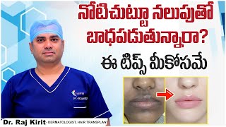 మూతి చుట్టూ నలుపు పోవాలంటే  How to Get Rid of Pigmentation Around the Mouth  Celestee Skin Clinic [upl. by Melina]