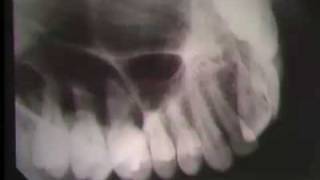 Occlusal Radiography [upl. by Greenquist264]