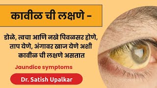 कावीळ ची लक्षणे कारणे व उपचार  डॉ सतीश उपळकर  Jaundice symptoms in Marathi [upl. by Lala]