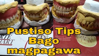 PUSTISO TIPS1 Bago mag pagawa ng Pustiso by DatuAmbasTv [upl. by Hobard]