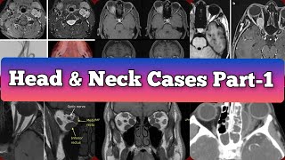 Radiology Viva Cases  367 375  Head and Neck Exam Cases Part 1 medical radiology [upl. by Ellehcear]