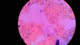 Live MicrofilariaParasite In Blood Under Microscope Captured In My Camera [upl. by Slade]