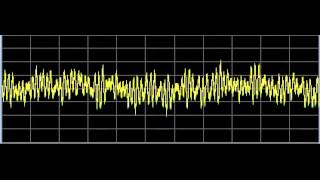 Alopecia Hair Loss  Rife Frequencies [upl. by Augustus992]