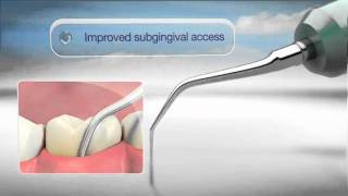 Cavitron ® FSI Slimline Einsätze  Subgingivale Behandlung [upl. by Hctim552]