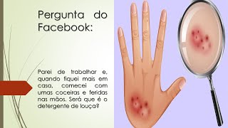 Estou com umas coceiras e feridas nas mãos  Pode ser o detergente de louça [upl. by Hall]