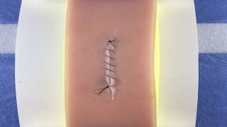 Simple Continuous Running Baseball Suture [upl. by Einaj]