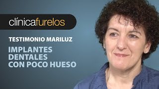 Mari Luz Implantes dentales con poco hueso [upl. by Anilocin364]