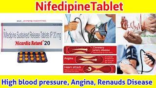 Nifedipine side effects  side effects of nifedipine tablet  common side effects of nifedipine [upl. by Whitaker]