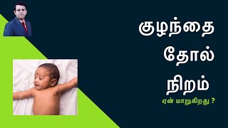 குழந்தை தோல் நிறம்  Baby Skin Colour  தமிழ் [upl. by Reivazx]