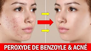 PEROXYDE DE BENZOYLE LA SOLUTION contre LACNÉ pourtant peu connue Dr Eyetemou Miguel Pharmacien [upl. by Meuse]