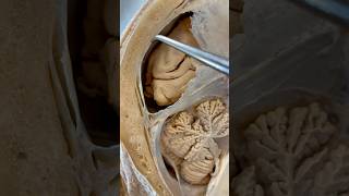 Incredible Tissue Surrounding Your Brain  Institute of Human Anatomy [upl. by Nwonknu257]