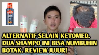 ALTERNATIF SHAMPO SELAIN KETOMED UNTUK MENUMBUHKAN RAMBUT BOTAK TENGAH REVIEW REVITA DAN ALPECIN [upl. by Kcirdde830]