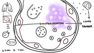 Pneumocystis jirovecii  Pneumocystis pneumonia [upl. by Ocimad]