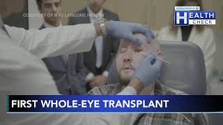 Surgeon patient show off firstever eye and partial face transplant [upl. by Brianna]