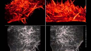 Narrated Filopodia Waving on the Surface of a HeLa Cell [upl. by Stich309]