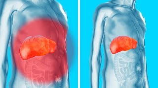 Débarrassetoi Des Toxines Dans Tes Reins Ton Foie et ta Vessie Doucement et Efficacement [upl. by Markos]