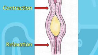 Swallowing Disorders and Achalasia [upl. by Novello]