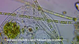 Stentors and Their Cilia [upl. by Bensky]