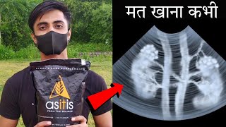 ASITIS Side Effects  हो गया खुलासा इस सस्ते ब्रांड का  Asitis Review protein gymlife [upl. by Lundquist140]