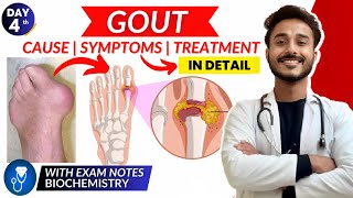 gout biochemistry  cause and symptom of gout  treatment of gout biochemistry [upl. by Eduardo595]