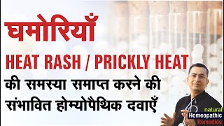 घमोरियाँ  Heat Rash  Prickly Heat  Natural homeopathic remedies with symptoms [upl. by Froemming]