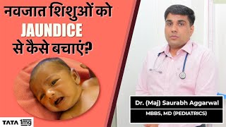 neonatal jaundice  बच्चो में jaundice in के causes symptoms और treatment [upl. by Downes229]