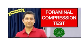 Foraminal Compression Test or Spurlings Test Cervical Radicular Syndrome [upl. by Roxy]