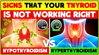 Signs and Symptoms That Your Thyroid Is In Trouble  Hypothyroidism vs Hyperthyroidism [upl. by Ahsoyem]