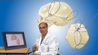 Plagiocephaly and its treatment  Boston Children’s Hospital [upl. by Rima]