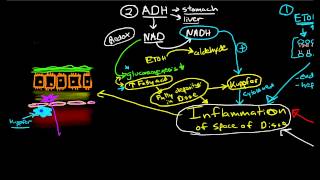 Pathophysiology of Cirrhosis [upl. by Ataymik21]