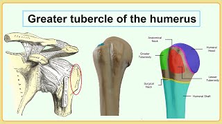 greater tubercle of the humerus [upl. by Sauls]