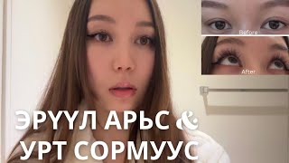 Арьсны бүх асуудлуудыг шийдэх эхний алхам [upl. by Snow817]