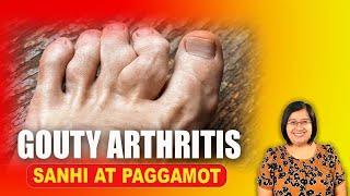 Gout Joint Pain  Arthritis Uric Acid  Bones Joints Muscles  Tagalog Health Tips  Nurse Dianne [upl. by Dikmen]